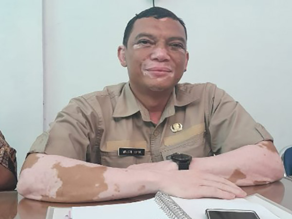Teknik Ampuh Mengatasi Gangguan Kelistrikan Dengan Pemahaman Aliran Arus Listrik